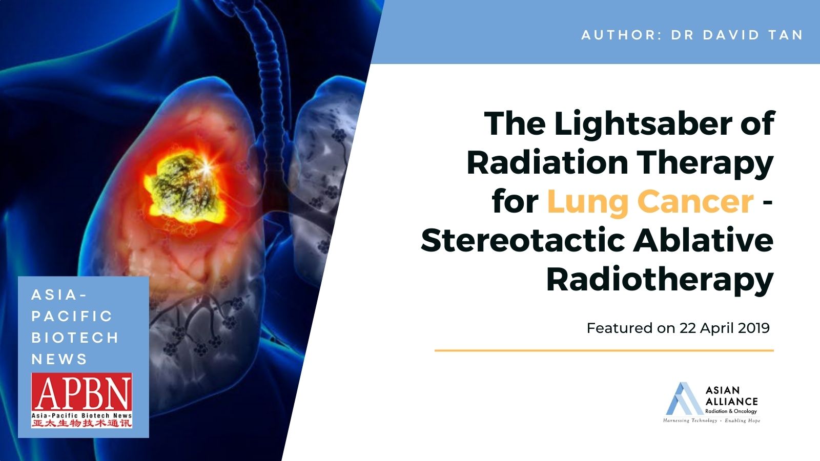 APBN: Stereotactic Ablative Radiotherapy - LightSABeR | AARO